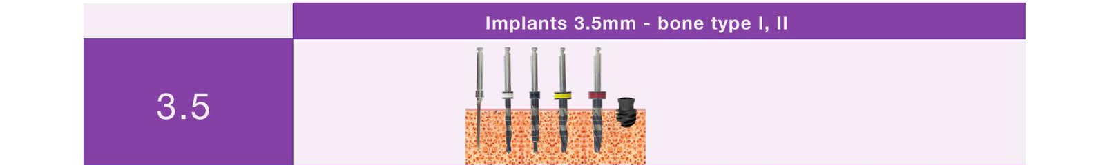 Drill sequence, implants 3.5mm, bone type I and II