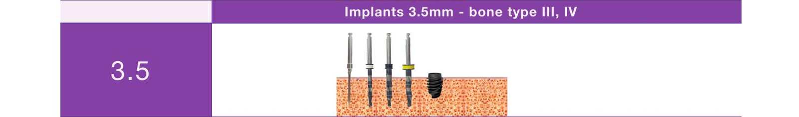Drill sequence, implants 3.5mm, bone type III and IV
