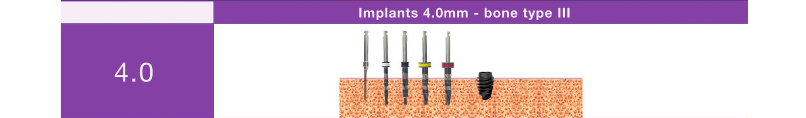 Drill sequence, implants 4.0mm, bone type III